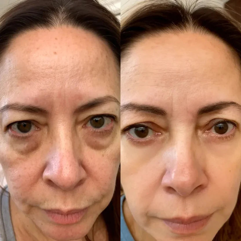 Xelumi RestorEyes® 2-in-1 Ocular Recovery Tech